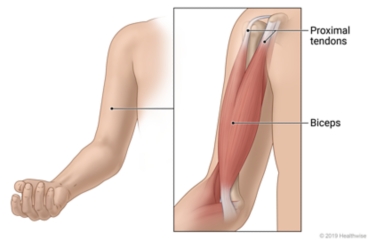 Location of biceps at front of upper arm, with inside view of proximal tendons attaching biceps to shoulder bone