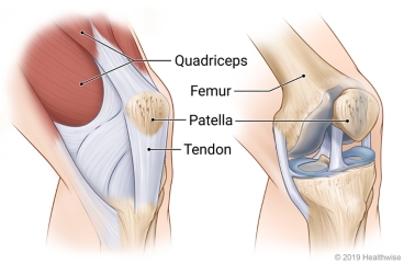 Bent knee joint, showing quadriceps becoming the patellar tendon and, along with bone (femur), connecting to the patella (kneecap) from above