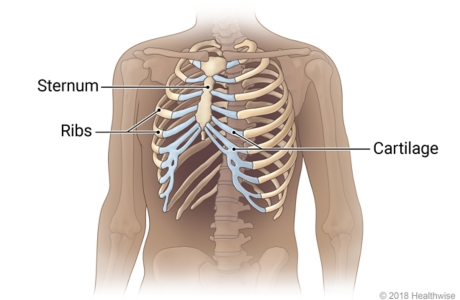 Skeletal view of rib cage, showing sternum, ribs, and cartilage