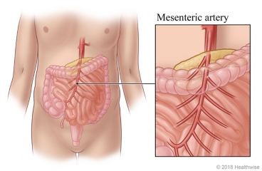Small and large intestine, with detail of mesenteric artery