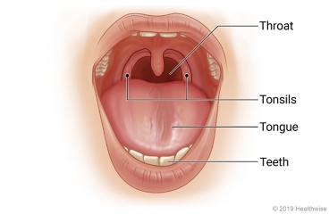 Open mouth, showing throat, tonsils, tongue, and teeth