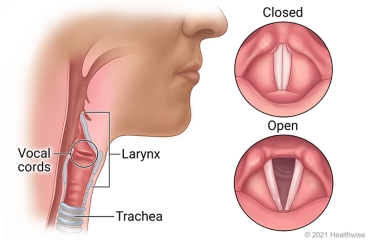 Inside view of throat, showing larynx, vocal cords, and trachea, with details of closed and open vocal cords.
