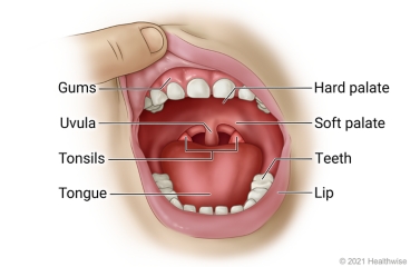 Open child's mouth, showing lips, gums, teeth, tongue, hard and soft palates, uvula, and tonsils.
