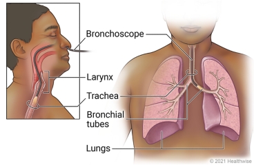 Path of bronchoscope through nose, larynx, trachea, and into bronchial tubes in lungs.