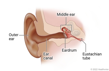 Anatomy of child's ear, showing outer ear, ear canal, eardrum, middle ear, and eustachian tube.