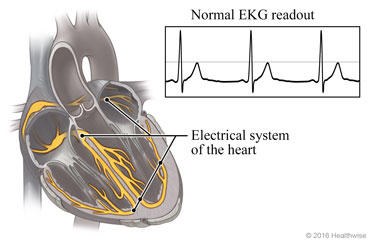 Electrical system of the heart and a normal EKG readout