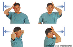 Hands-on-head strengthening exercise.