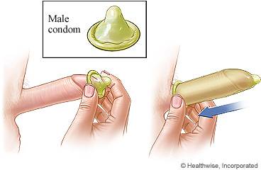 Male condom method of birth control