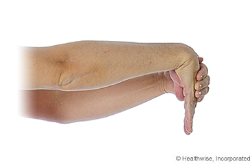 Picture showing how to do wrist extensor stretch