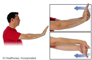 Picture showing how to do wrist flexor stretch