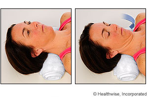 Picture of chin tuck exercise