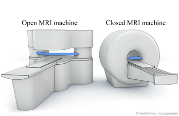 An open and a closed MRI machine