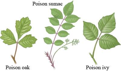 Poison oak, poison sumac, poison ivy.