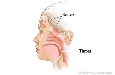 Sinuses and throat of a child