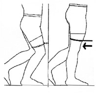 person standing with elastic band around 1 thigh while straightening same knee