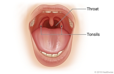 Location of the tonsils and throat