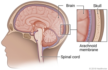 A cross-section of the brain and spinal cord in the head, with detail of the brain, the arachnoid membrane, and the skull.