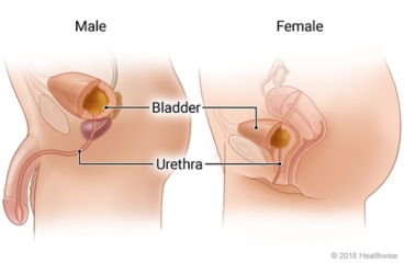 Urethral Dilation: What to Expect at Home