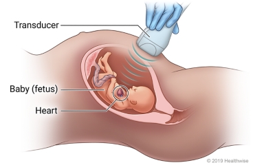 Echocardiogram transducer on a pregnant woman's belly, with cross section of uterus showing sound waves measuring the baby's heart.