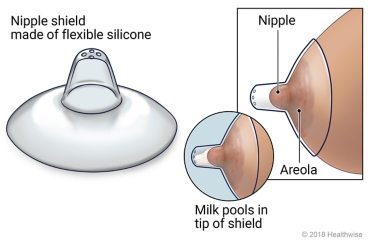 Nipple shield, with detail showing placement on breast and milk pooling in tip of shield