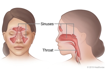 Person's face and neck, showing front and side views of sinuses and throat