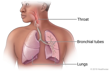 Lungs in chest showing bronchial tubes in one lung.