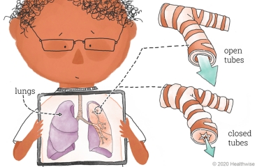 Arthur shows what his lungs look like, with a close-up of the tubes