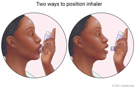 Two positions shown for using inhaler, one in mouth with lips closed around mouthpiece, and one placed 2.5 to 5 centimetres (1 to 2 inches) from open mouth.