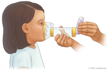 Adult putting mask spacer with inhaler over child's mouth and nose.