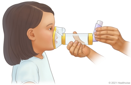 Adult placing mask of spacer over child's mouth and nose.