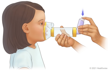 Adult holding mask spacer over child's nose and mouth, while pressing down on inhaler to release medicine into spacer.