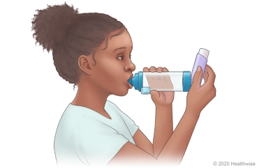 Child using asthma inhaler with spacer.