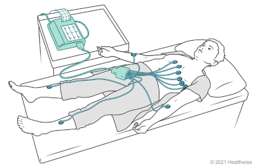 Person lying down with electrodes placed on chest, arms, and legs, which are connected to an EKG machine.