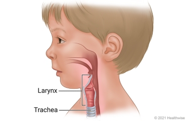 Side view of child's airways, including larynx and trachea.