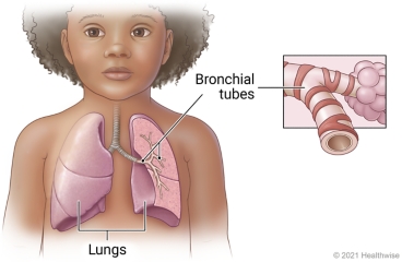 Respiratory system of a child, showing lungs and detail of bronchial tubes.