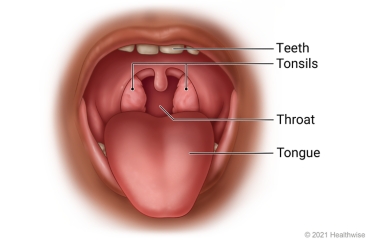 Baby sore throat: Treatments that soothe a baby's sore throat