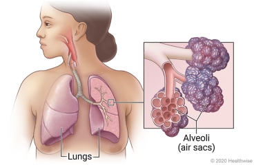 Location of lungs in chest, with inside view of lung and detail of alveoli (air sacs) at ends of airways.