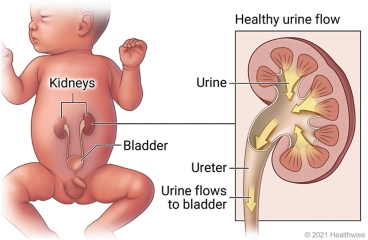 Location of kidneys and bladder in newborn, with detail of inside kidney showing normal flow of urine into ureter and bladder.
