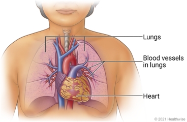 Inside view of chest showing lungs, blood vessels in lungs, and heart.