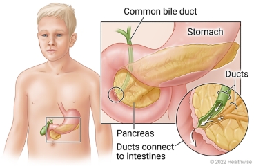 Pancreas behind stomach in child's belly, with detail of common bile duct and pancreatic duct connecting to intestines.