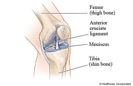 The anterior cruciate ligament (ACL).