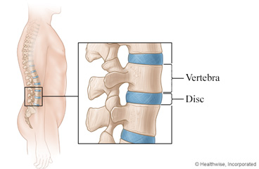Discs of the spine