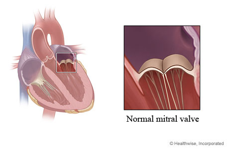 Location of mitral valve in heart. showing normal valve