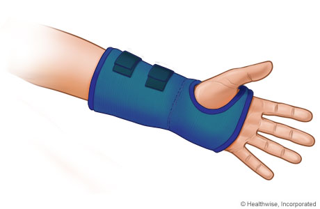  Carpal Tunnel Wrist Splint : Health & Household