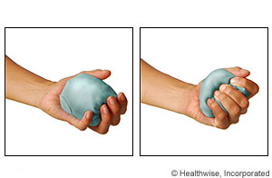 Picture of the ball or sock squeeze exercise