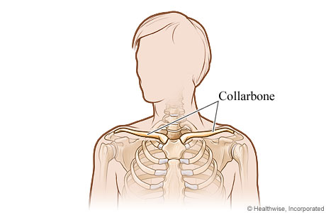 The collarbone (clavicle).