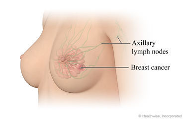 Location of auxillary lymph node near a breast