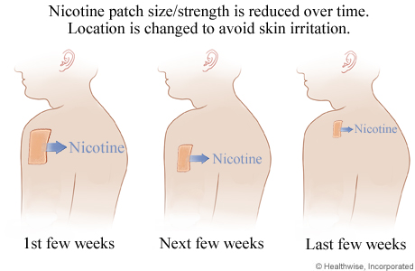 Nicotine Patches Healthing Ca