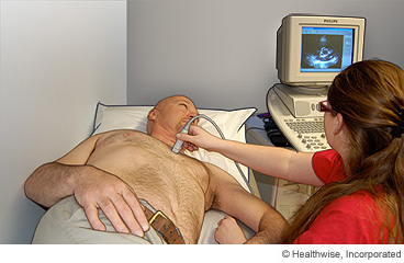 Man getting an echocardiogram