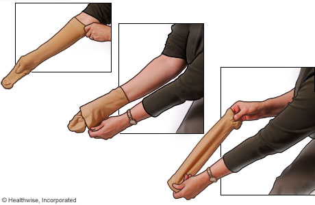 How to Wear and Care for Compression Stockings
